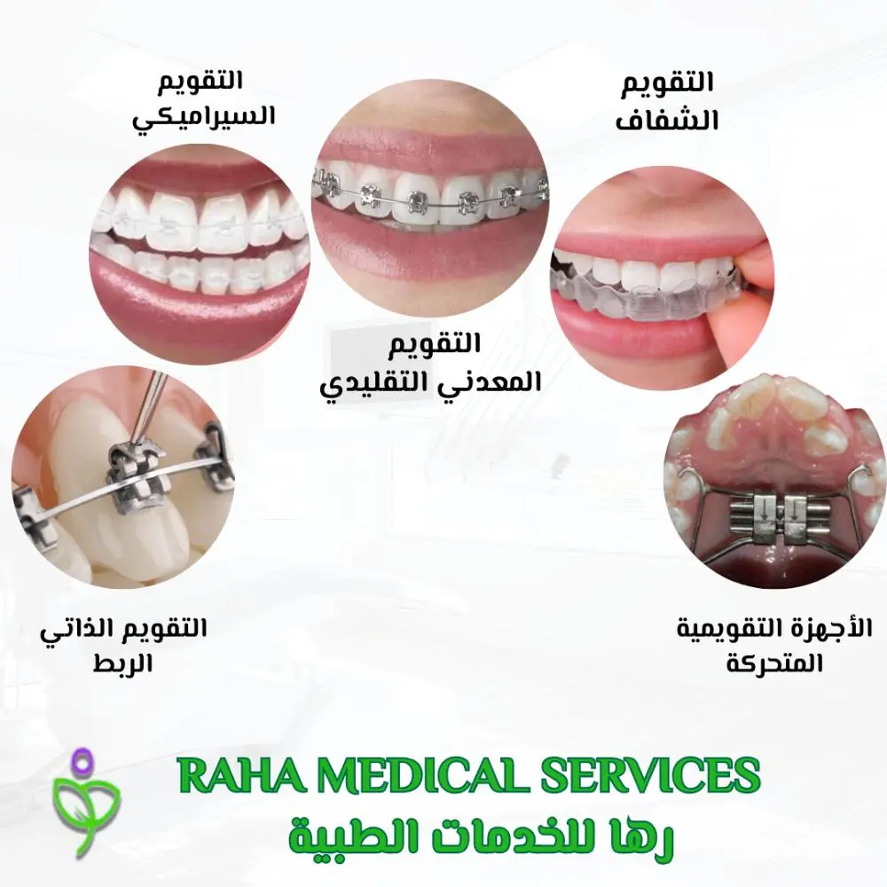 أنواع تقويم الأسنان المتاحة بالرياض